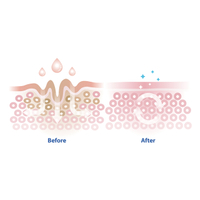 Barrier Regeneration