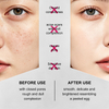 skin care of Sponge bone needle microcrystals
