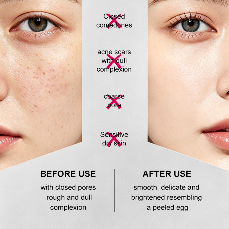 skin care of Sponge bone needle microcrystals